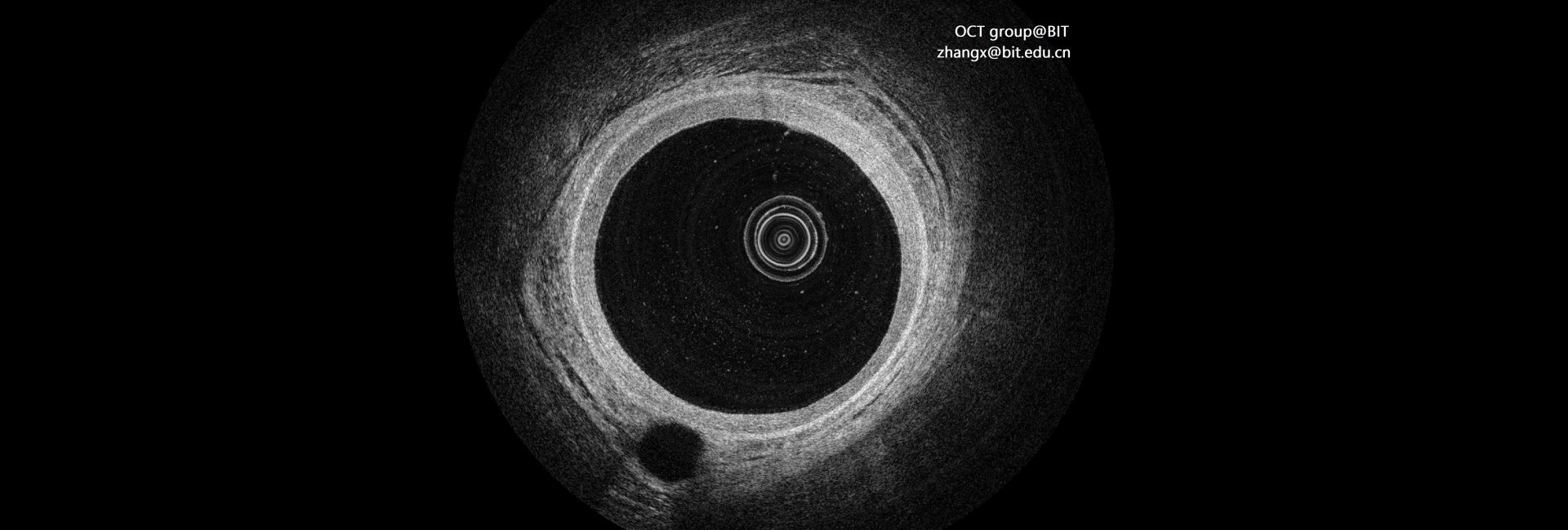 Intravascular Optical Coherence Tomography，IVOCT