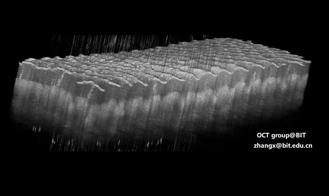 人皮肤的OCT三维图像