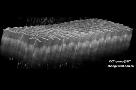 人皮肤的OCT三维图像